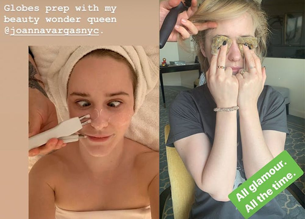 Fotó: Instagram Olcsó trükk lehűtött teafilterekkel enyhíteni a duzzanatokat