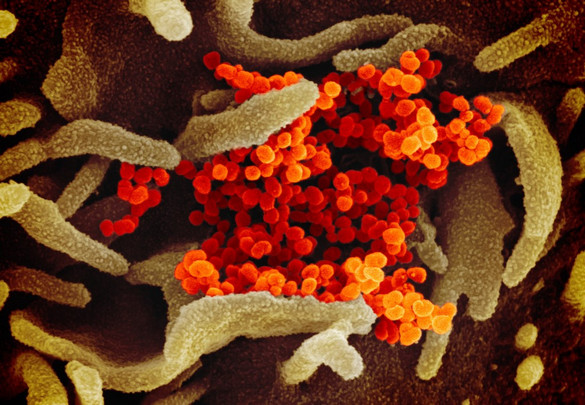 Látványos videó arról, hogyan pusztítja a sejtjeinket a koronavírus