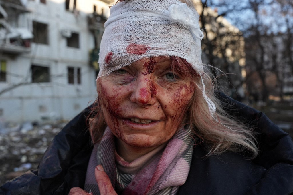 Sebesült nő Harkov mellett, akinek egy légicsapás megsemmisítette az otthonát
