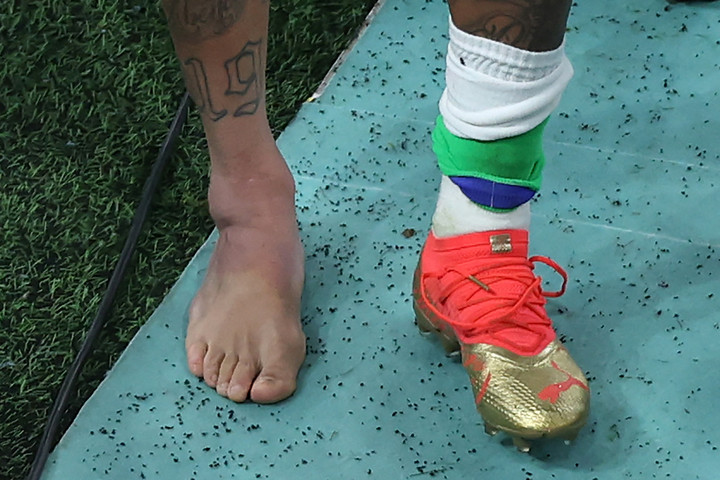 Neymar bokájáért aggódik Brazília
