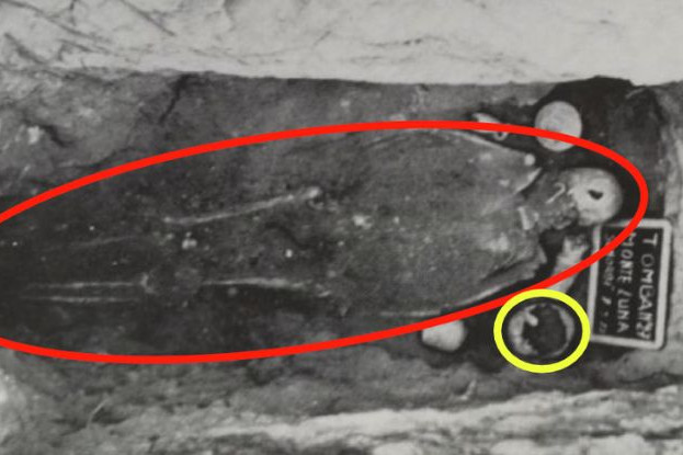 Fotó: sciencedirect Egy lyuk ebben a római koponyában elavult közegészségügyi intézkedés lehetett