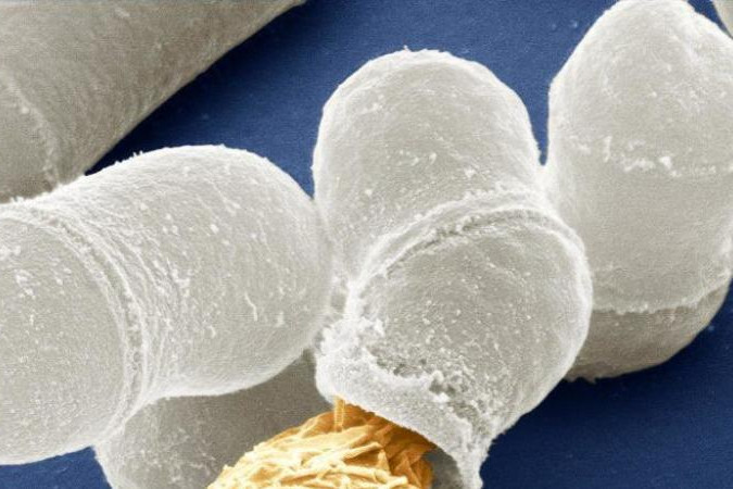 Fotó: Flickr/Zeiss Microscopy Ez a felfedezés megmagyarázhatja az evolúció egyik legnagyobb rejtélyét
