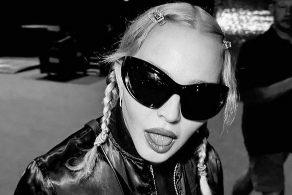 Madonna nagyon rossz állapotban van