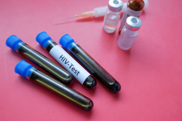 Felfedezték, hogy a HIV szunnyad az emberi agy immunsejtjeiben