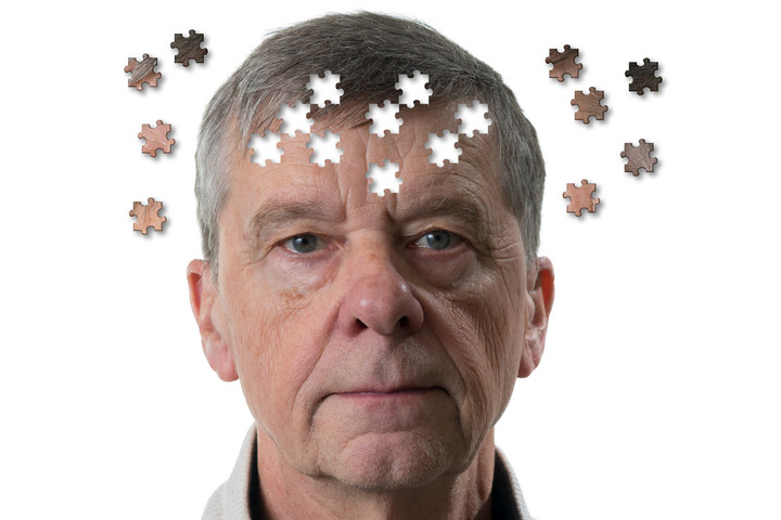 Fotó: NorthFoto Az Alzheimer-kór diagnosztizálásának lehetséges új módja