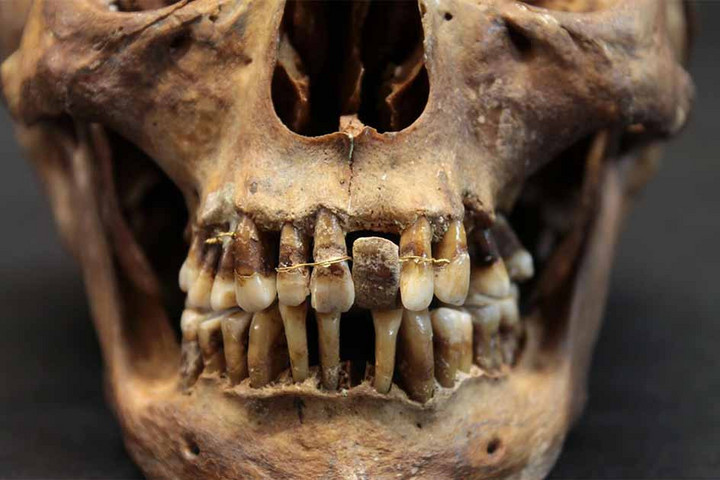 Fotó: Facebook/The Tudor Intruders Ennek a 17. századi arisztokratának volt egy ravasz titka a fogai megőrzésére