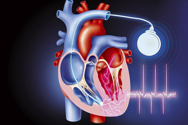 Fotó: JACOPIN / BSIP / BSIP via AFP Megkezdte a működését az ország első pacemaker-távambulanciája