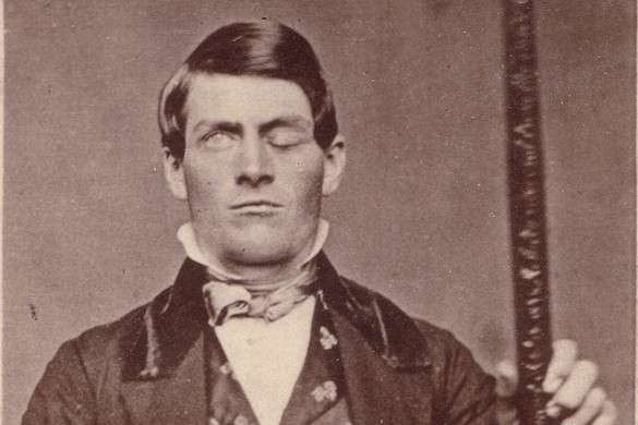 Hogyan változtatta meg Phineas Gage felnyársalt agya örökre az orvostudományt?