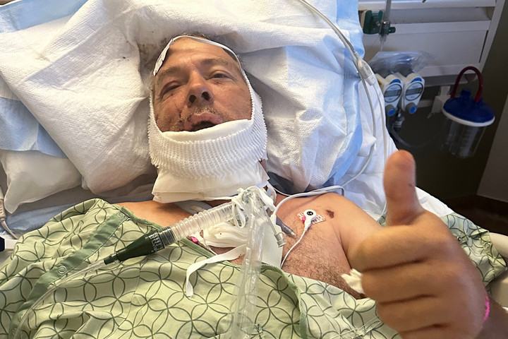 Fotó: MH/GoFundMe/KathyNoorlander A fél arcát letépte egy grizzly egy montanai férfinak