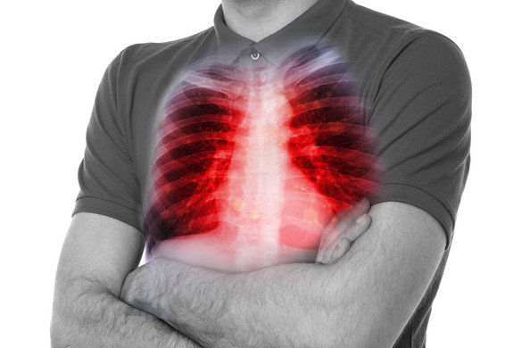 A tüdőrák négy fontos jele, amely reggel jelentkezik