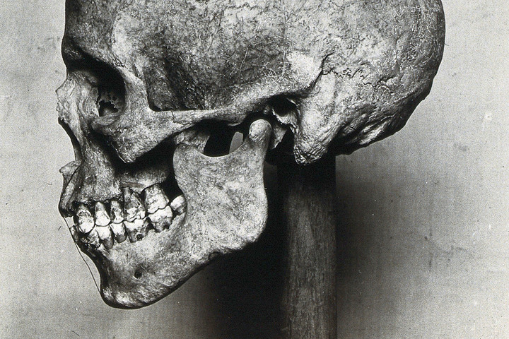 Fotó: NorthFoto A vikingek fogromlástól szenvedtek