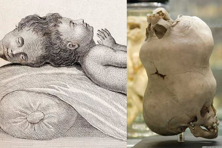 Fotó: Instagram/sciencesetfree Élet két fejjel? Lehetséges!