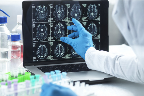 Új tudományos dimenzió a klinikai kutatásokban és a terápiás fejlesztésekben