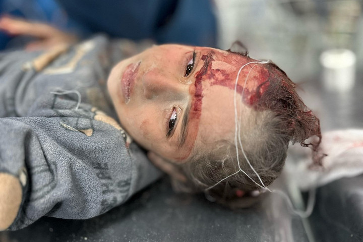 Fotó: AFP/Anadolu/Doaa Albaz Lőtt sebekkel kerültek kórházba a gázai eset érintettjei