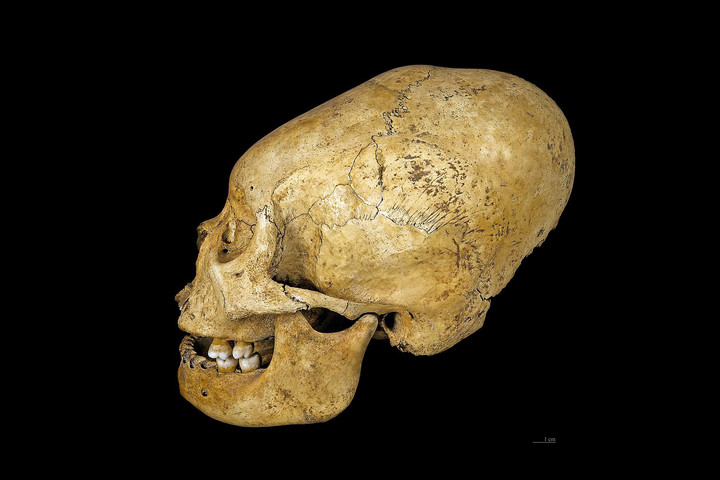 Bizarr koponyamódosítást fedeztek fel három viking nőnél
