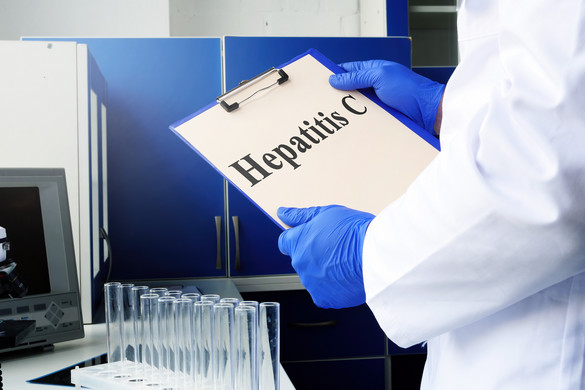 Világszerte körülbelül ötvenmillió ember él hepatitis C-vel, de sokan nem is tudnak róla
