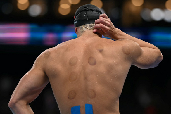 Mik ezek a sötét karikák a sportolókon az olimpián?