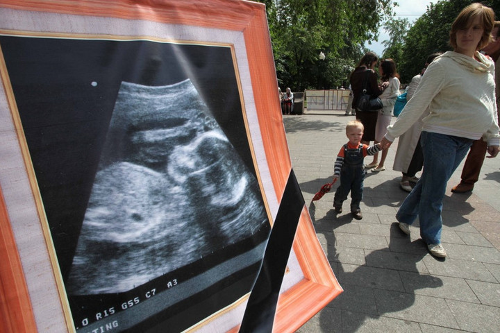A Duma sem tartja jó ötletnek az abortusz betiltását