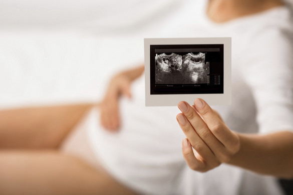 Kockázatokkal járhat az epidurális szülés