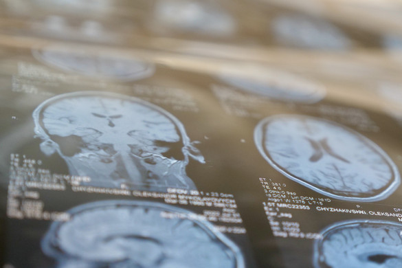 Öt szokás, ami minden nap butábbá tesz minket