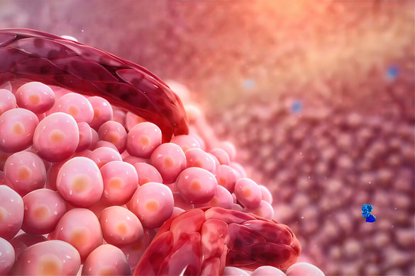 Fotó: NorthFoto Új terápiás megközelítés a rákgyógyításban