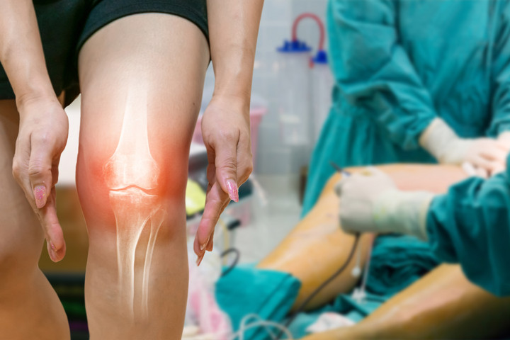 Fotó: NorthFoto Milliók szenvednek osteoarthritisben – ez a diéta védi az ízületeket