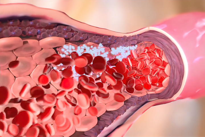 Fotó: NorthFoto Rémisztő dolgot találtak az emberi vérben