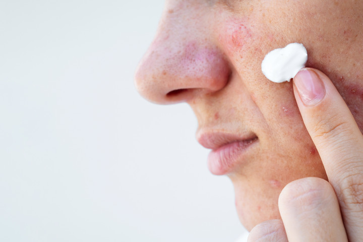 Fotó: NorthFoto Magas tesztoszteronszint nőknél