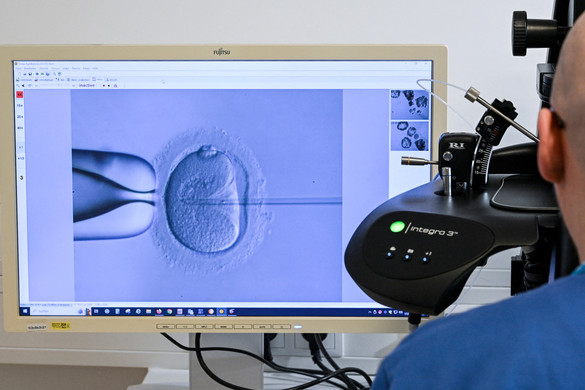 A mesterséges megtermékenyítés eredményességét javító inkubátort fejlesztenek