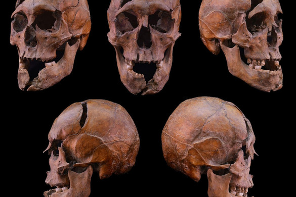 Régészeti csoda: kiderült, ki és hogyan végezhetett Macsói Bélával