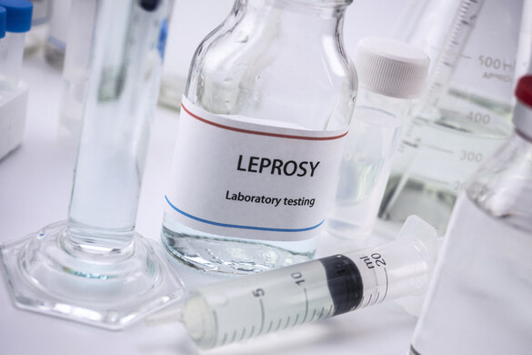 Terjed a lepra Romániában