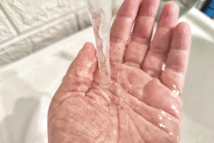 Miért ráncosodik a kéz bőre a víztől?