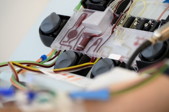 Mi az, ami csökkentheti a rák kockázatát?