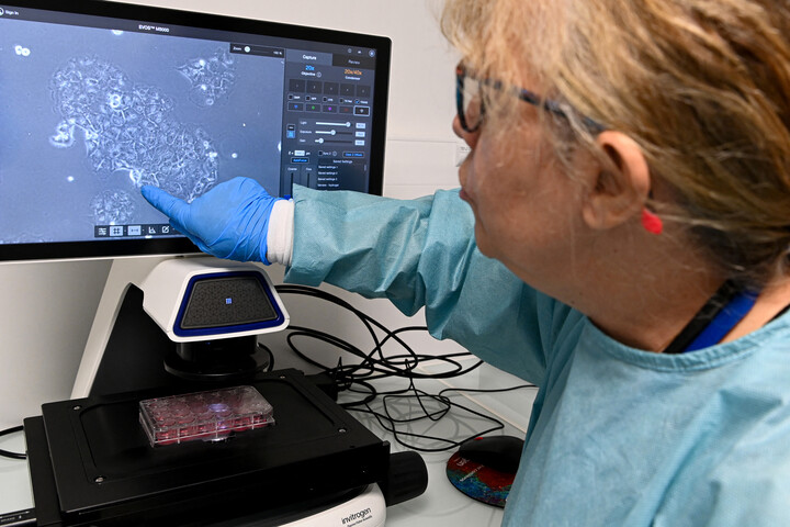 Így állítható meg a legrettegettebb rák