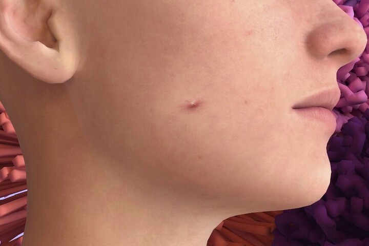 Egyszerű módszerek a sérült bőr védőrétegének helyreállítására