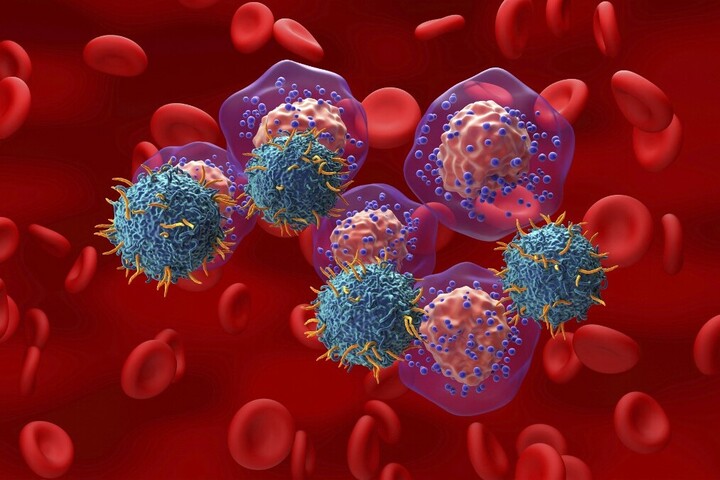 A legtöbb megelőzhető rákos megbetegedés csupán két életmódbeli szokáshoz kapcsolódik