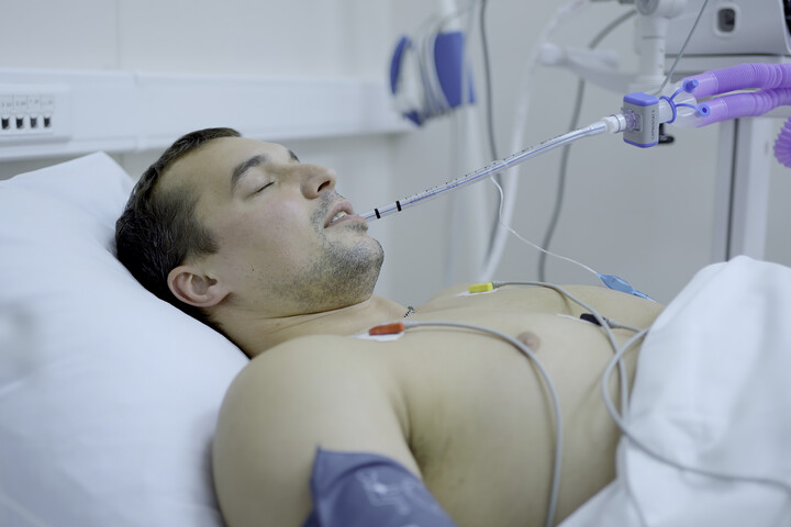 Egy módszer, amivel csökken a beteg halálának kockázata