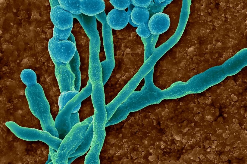 Színes pásztázó elektronmikroszkópos (SEM) felvétel a gyakori környezeti és allergén penészgombáról (Cladosporium sp.); spórákat termelő gombafonalak. Hormodendrum sp. néven is ismert. Ezt a példányt egy épület légcsatornájának belső felületén találták. Ez a nemzetség a leggyakoribb kültéri, levegőben terjedő penészgomba, de otthonokban is előfordulhat.