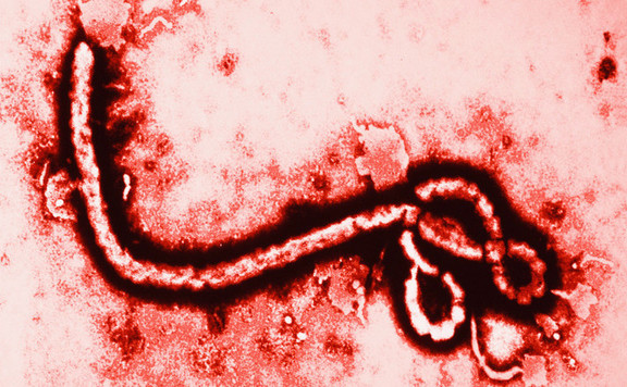 ebola576