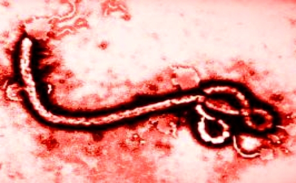 Ebola vírus