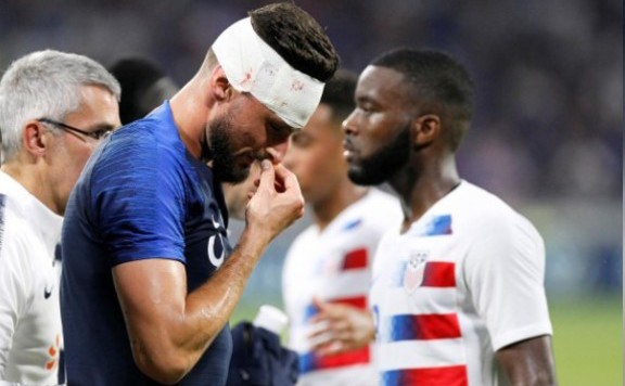 giroud