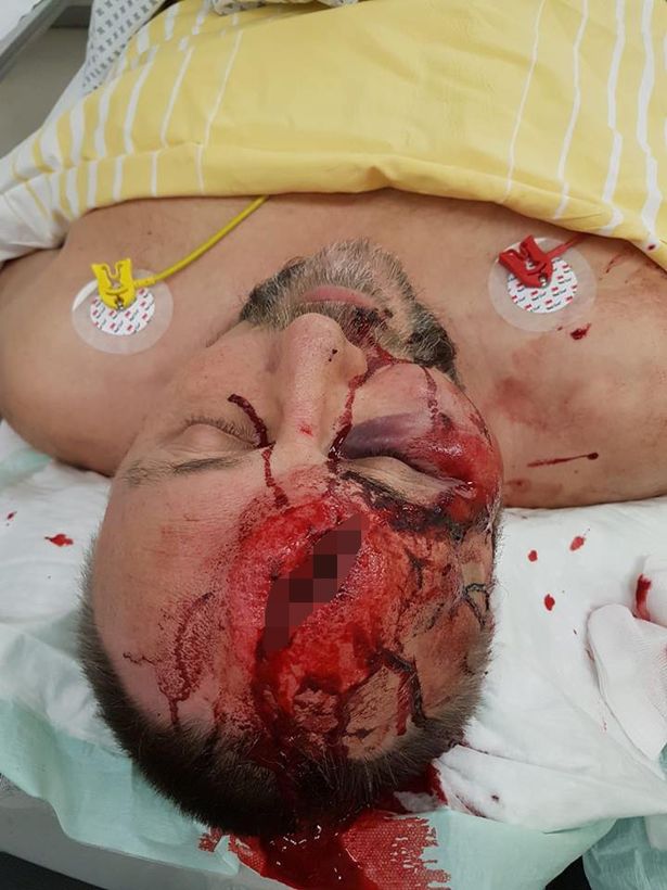 Forrás: mh szétvert magnitz